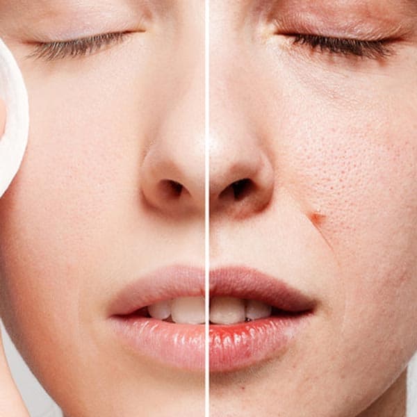 Custom Medi Facial at Skin Method in Vancouver